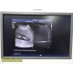 Philips C5‑1 Curved Array Ultrasound Probe | 453561224483 | iU22 Tested ~ 40144