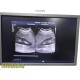 Philips C5‑1 Curved Array Ultrasound Probe | 453561224483 | iU22 Tested ~ 40144