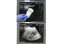 Philips C5-2 40R (4000-0574-06) Curved Array Ultrasound Transducer Probe ~ 21278