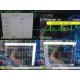2015 Philips IntelliVue MX800 Monitor w/ X2 M3012A CO 865297 Battery Ext ~ 40718