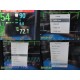 2015 Philips IntelliVue MX800 Monitor w/ X2, M3012A, Module Rack & Leads ~ 40234