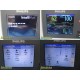 2015 Philips IntelliVue MX800 Monitor w/ X2, M3012A, Module Rack & Leads ~ 40234