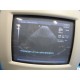 Acuson 3V2c Wideband Phased Array Ultrasound Transducer for Acuson Sequoia~13519