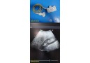 Acuson 6C2 Convex Array Ultrasound Transducer Probe ~ 21727