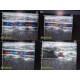Acuson 17L5 Model 10035724 HD Linear Array Ultrasound Transducer Probe ~21730