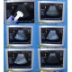 2008 GE LogiQ P5 Flat-Screen Ultrasound W/ 4C & 12L Transducers / Probes ~ 21773