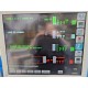 SPACELABS Ultraview SL Touch 91387 Monitor W/ Module Leads Keyboard Stand~14323