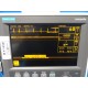 GE MARQUETTE Eagle 300 ( NBP SpO2 EKG Temp Print) Monitor W/ Stand & Leads~14321