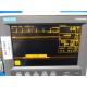 GE MARQUETTE Eagle 300 ( NBP SpO2 EKG Temp Print) Monitor W/ Stand & Leads~14321