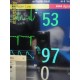 Philips Intellivue X2 M3002A Patient Monitor Ref 8650397 Companion Module~33525