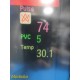 Philips IntelliVue MP70 M8007A FMS MMS BIS CO IBP Nellcor SpO2 Monitor ~40800