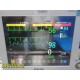 2016 Philips Intellivue M3002A X2 Patient Monitor 865039 Companion Module~33526