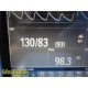 2015 Philips Intellivue MP5SC Spot Check Monitor W/ NEW Patient Leads ~ 35063