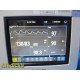 2015 Philips Intellivue MP5SC Spot Check Monitor W/ NEW Patient Leads ~ 35063