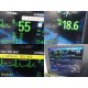 2015 Philips IntelliVue MX800 Monitor w/ X2, FMS Rack, M3015A CO2, Modules~39403