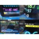 2015 Philips IntelliVue MX800 Monitor w/ X2, FMS Rack, M3015A CO2, Modules~39403