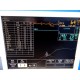 GE SOLAR 8000 Monitoring System W/ Chromamxx 15" LCD Rack Modules & Leads 