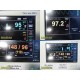 2014 Spacelabs Ultraview DM3 Vital Signs Monitor W/ PSU & Leads ~ 40183