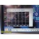 2012 Philips MP5 M8105A (865024) Monitor (NBP, SPO2, ECG, IBP, T) W/ Leads~33092