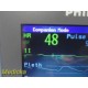 2011 Philips Intellivue MMS X2 M3002A Companion Module/Monitor W/ Battery ~35483