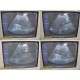2009 Siemens CH4-1 Convex Array Ultrasound Transducer Probe (07472256) ~ 27254