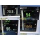 Datascope Passport 2 Patient Monitor (ECG SpO₂ NIBP Temp IBP CO₂) w/ Leads~40682