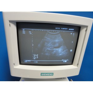 https://www.themedicka.com/277-2916-thickbox/2005-siemens-sonoline-g20-ultrasound-w-c5-2-convex-transducer-printer.jpg