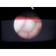 AUTOSUTURE 2mm x 275mm, 0 degree Neuroscope / Rigid Telescope ~13826