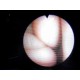 MACHIDA ENT-4LS (ENT4LS) Flexible Fiberoptic Rhinolaryngoscope W/ Case ~ 13855