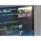 Agilent V24C (NBP SpO2 EKG & Print) Patient Monitor W/ Rack Modules &Leads~14593