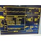 Datascope Passport XG (NIBP EKG SpO2 2x IBP Temp Print) Monitor W/ Leads ~14681