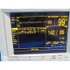 Datascope Passport XG (NIBP EKG SpO2 Temp Print) Patient Monitor W/ Leads~14683