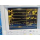 Datascope Passport XG (NBP IBP ECG SpO2) Monitor W/ EKG NIBP SpO2 Leads~14685-86