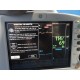 GE DASH 3000/4000 V5 Colored Patient Monitor (NBP SpO2 ECG T/CO) W 2 Leads~16075