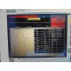 Siemens SC 7000 Monitor W/ Docking Station (No Power Supply No Leads) ~16325