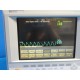 HP VIRIDIA 24C CRITICAL CARE MONITOR (NBP ECG SpO2 CO / T Print) W/ LEADS~14542