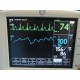GE DASH 3000 Vitals Monitor (NBP IBP SpO2 ECG T/CO2) W/ SpO2 NBP EKG Lead~17315