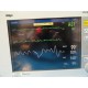 Drager Infinity Gamma XXL Patient Monitor WITH LEADS AND POWER MODULE ~ 17251