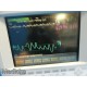 HP V24C M1205A Critical / Cardiac Care Patient Monitor ~ SDN DTM CO CO2 ~ 14565