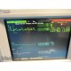 HP OmniCare M1204A Multi-Parameter Patient Monitor W/ NBP SpO2 EKG leads ~ 14575