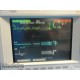 HP OmniCare M1204A Multi-Parameter Patient Monitor W/ NBP SpO2 EKG leads ~ 14575