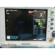 GE DASH 3000 Monitor (CO2 SpO2 ECG NBP T/IBP) W/ T / IBP SpO2 NBP EKG Lead~17420