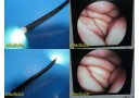 Vision Sciences S-F100 Endoscope Flexible Sigmoidoscope ~ 16951