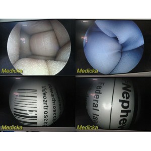 https://www.themedicka.com/6393-69629-thickbox/smith-nephew-dyonics-7205922-4mm-x-30-video-arthroscope-telescope-16973.jpg