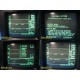 Datex Ohmeda Capnomac Ultima ULT-SVi-27-09 Anesthesia Monitor W/ H20 Trap~18032