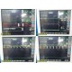 SPACELABS Ultraview SL Monitor W/ Command & CO2 Modules Leads & Stand~ 18923