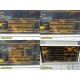 Datascope Passport EL (CO2 SPO2 TEMP ECG IBP) Monitor W/ Leads + Battery ~ 18483
