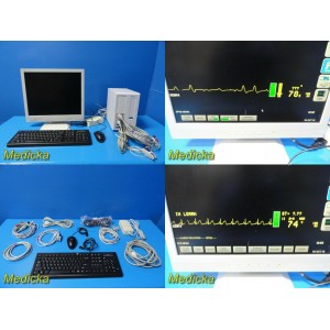 https://www.themedicka.com/7981-87808-thickbox/spacelabs-ultraview-sl3800-patient-monitor-w-90496-module-new-leads-19329.jpg