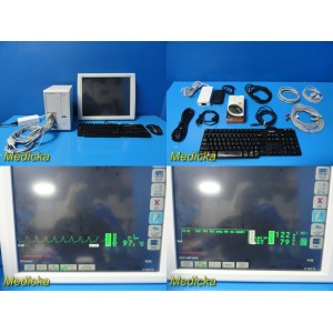 https://www.themedicka.com/8038-88472-thickbox/2013-spacelabs-ultraview-sl3800-patient-monitor-w-p90496-module-leads19340.jpg