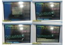 HP Agilent M1205A/1204A V24C Patient Monitoring Sys W/ Modules & Leads ~ 20223